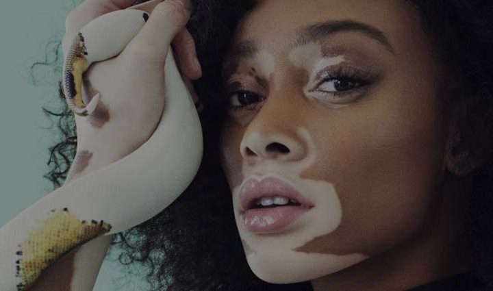 Intervista a Winnie Harlow già volto di Desigual e Diesel, che ora è pronta e determinata a rivoluzionare i canoni estetici nel mondo della moda